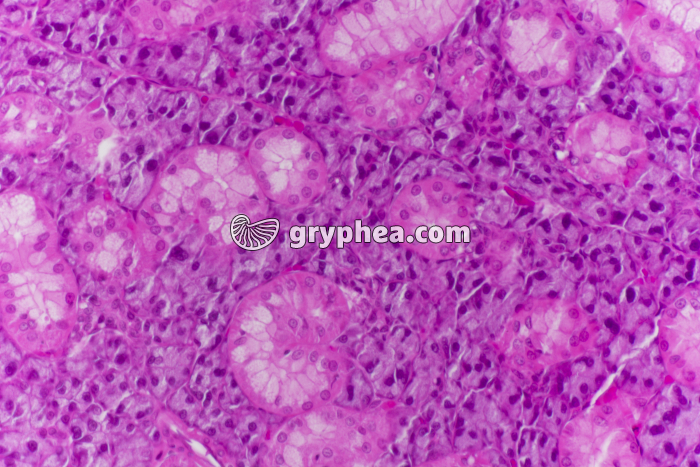 Parathyroïde x100 - gryphea.com